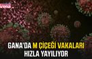 Gana’da M Çiçeği vakaları hızla yayılıyor