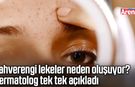 Kahverengi lekeler neden oluşuyor? Dermatolog tek tek açıkladı