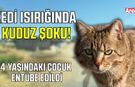 4 yaşındaki çocuğu ısıran kedi kuduz çıktı