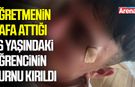 Öğretmenin kafa attığı 16 yaşındaki öğrencinin burnu kırıldı