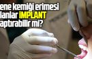 Çene kemiği erimesi olanlar implant yaptırabilir mi?