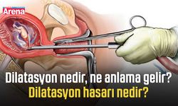 Dilatasyon nedir, ne anlama gelir? Dilatasyon hasarı nedir?