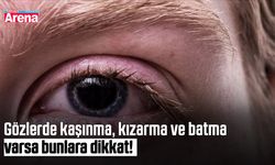 Gözlerde kaşınma, kızarma ve batma varsa bunlara dikkat!