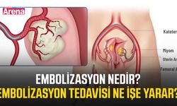 Embolizasyon nedir? Embolizasyon tedavisi ne işe yarar?