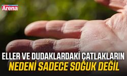 Eller ve dudaklardaki çatlakların nedeni sadece soğuk değil