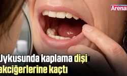 Uykusunda kaplama dişi akciğerlerine kaçtı