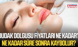 Dudak dolgusu fiyatları ne kadar? Ne kadar süre sonra kaybolur?