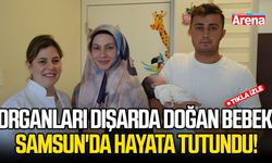 Organları dışarda doğan bebek Samsun'da hayata tutundu