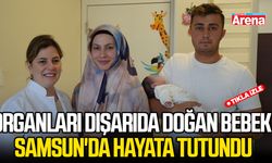 Organları dışarıda doğan bebek Samsun'da hayata tutundu