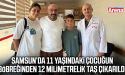 Samsun’da 11 yaşındaki çocuğun taşı tek seansta temizlendi