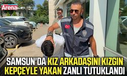 Samsun'da kız arkadaşını kızgın kepçeyle yakan zanlı tutuklandı