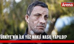 Türkiye’nin ilk yüz nakli nasıl yapıldı?