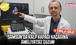 Samsun’da kalp kapağı kaçağına ameliyatsız çözüm