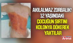 Akılalmaz zorbalık! Çocuğun sırtını kolonya dökerek yaktılar