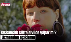 Kıskançlık ciltte sivilce yapar mı? Uzmandan açıklama