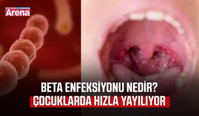 Beta enfeksiyonu nedir? Çocuklarda hızla yayılıyor