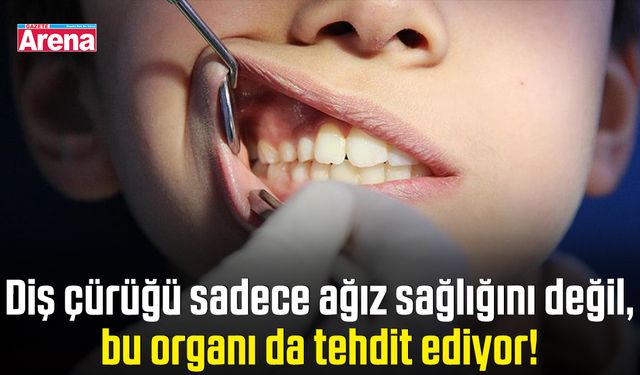 Diş çürüğü sadece ağız sağlığını değil, bu organı da tehdit ediyor!