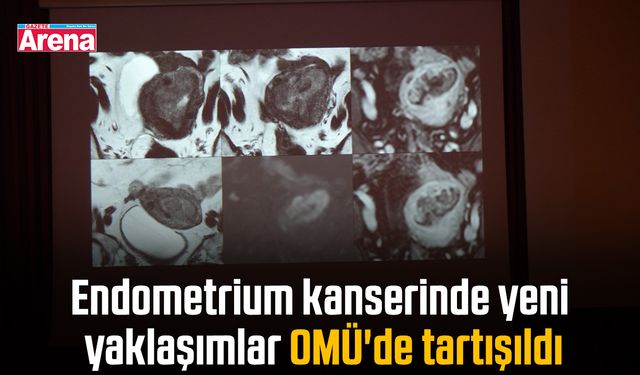 Endometrium kanserinde yeni yaklaşımlar OMÜ'de tartışıldı