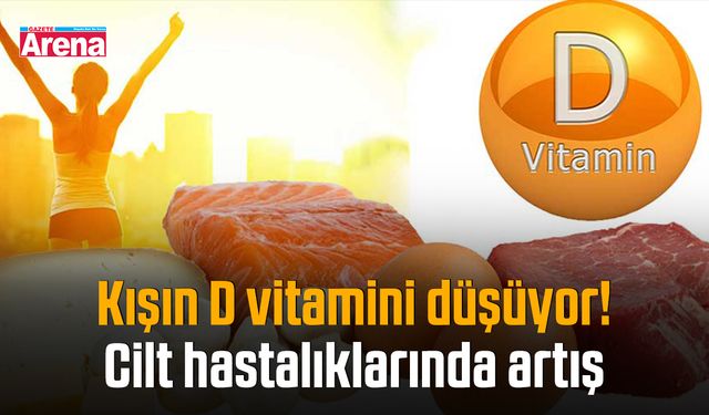 Kışın D vitamini düşüyor! Cilt hastalıklarında artış
