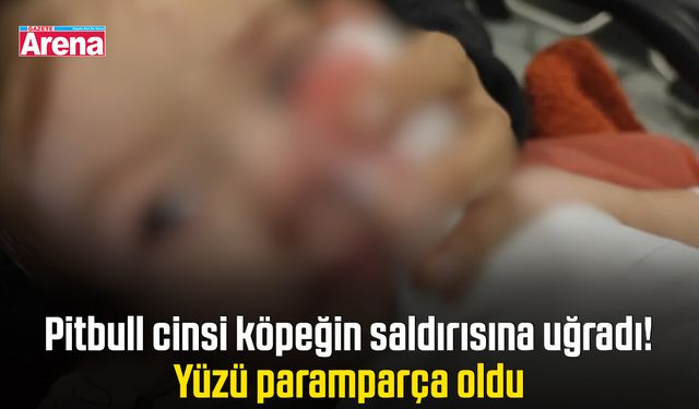 Pitbull cinsi köpeğin saldırısına uğradı! Yüzü paramparça oldu