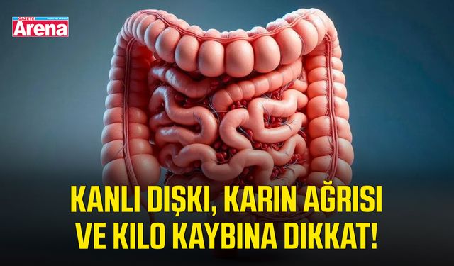 Kanlı dışkı, karın ağrısı ve kilo kaybına dikkat!