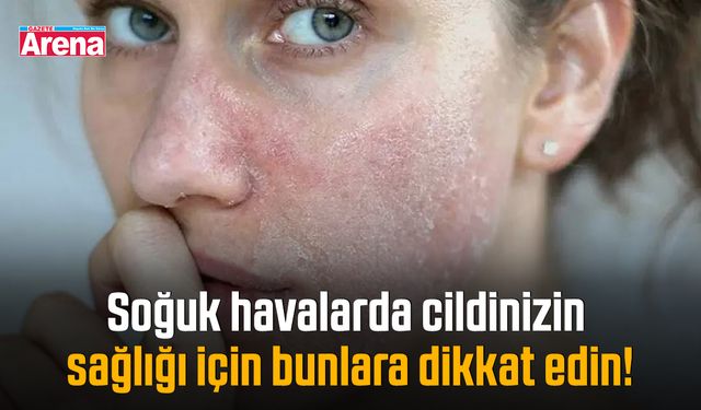 Soğuk havalarda cildinizin sağlığı için bunlara dikkat edin!