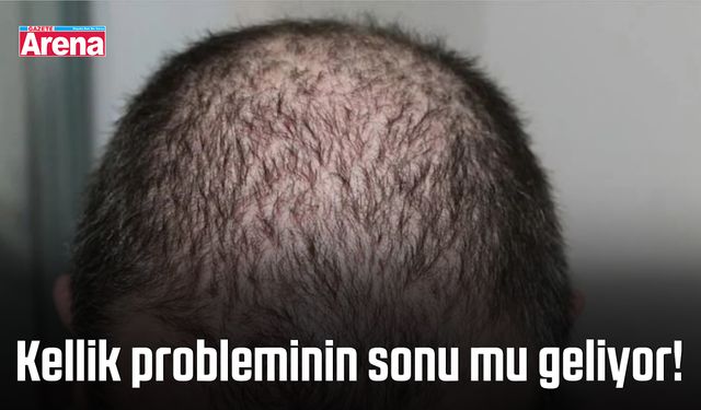 Kellik probleminin sonu mu geliyor!