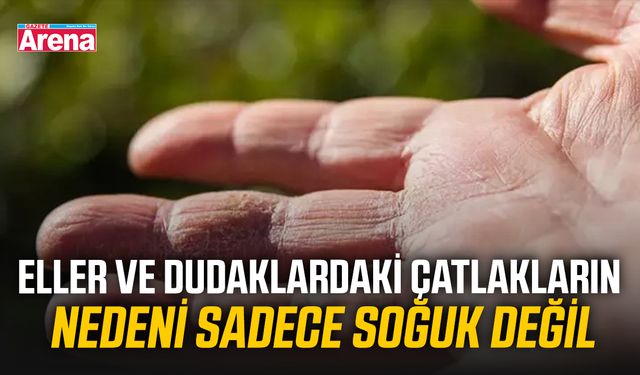 Eller ve dudaklardaki çatlakların nedeni sadece soğuk değil