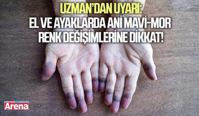 El ve ayaklarda ani mavi-mor renk değişimlerine dikkat