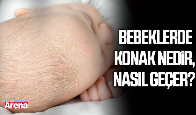 Bebeklerde konak nedir, nasıl geçer?