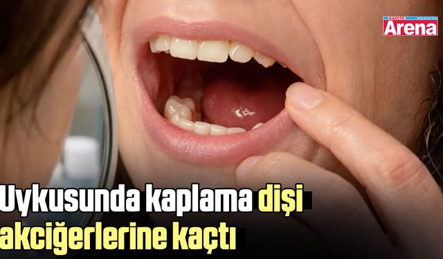 Uykusunda kaplama dişi akciğerlerine kaçtı