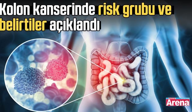 Kolon kanserinde risk grubu ve belirtiler açıklandı