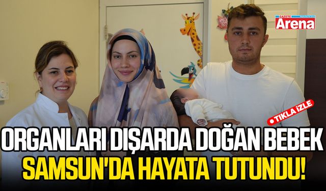 Organları dışarda doğan bebek Samsun'da hayata tutundu