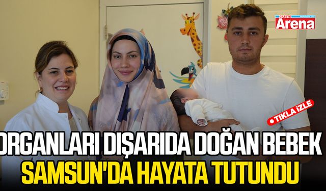 Organları dışarıda doğan bebek Samsun'da hayata tutundu
