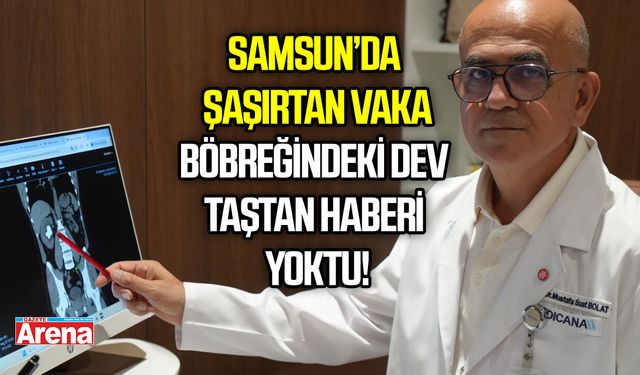 Samsun’da şaşırtan vaka! Böbreğindeki dev taştan haberi yoktu