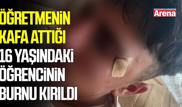 Öğretmenin kafa attığı 16 yaşındaki öğrencinin burnu kırıldı