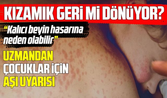 Uzmanından kızamık uyarısı: Kalıcı beyin hasarına yol açabilir