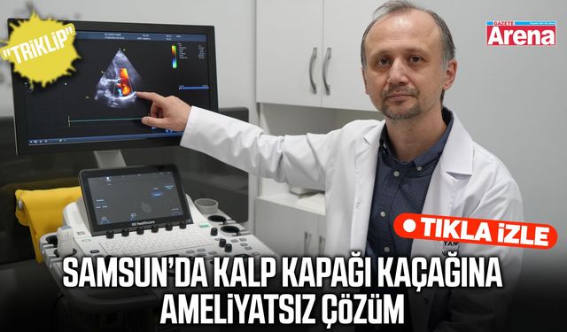 Samsun’da kalp kapağı kaçağına ameliyatsız çözüm