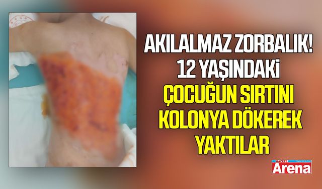 Akılalmaz zorbalık! Çocuğun sırtını kolonya dökerek yaktılar