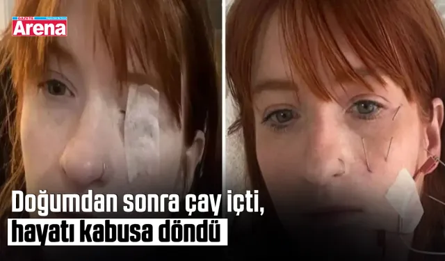 Doğumdan sonra çay içti, hayatı kabusa döndü