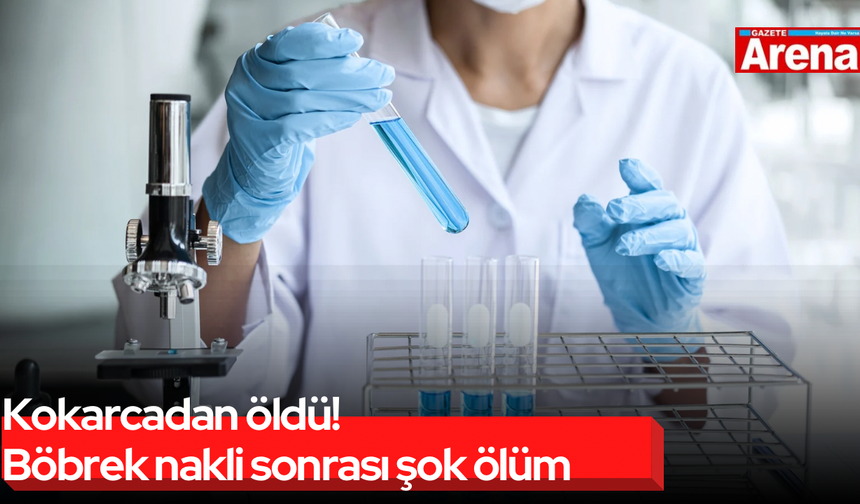 Kokarcadan öldü! Böbrek nakli sonrası şok ölüm