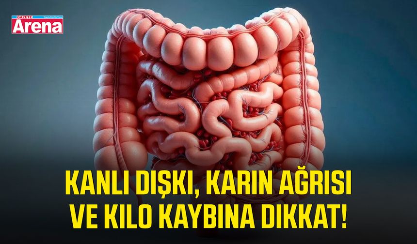 Kanlı dışkı, karın ağrısı ve kilo kaybına dikkat!