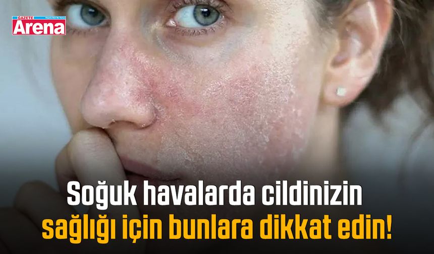 Soğuk havalarda cildinizin sağlığı için bunlara dikkat edin!