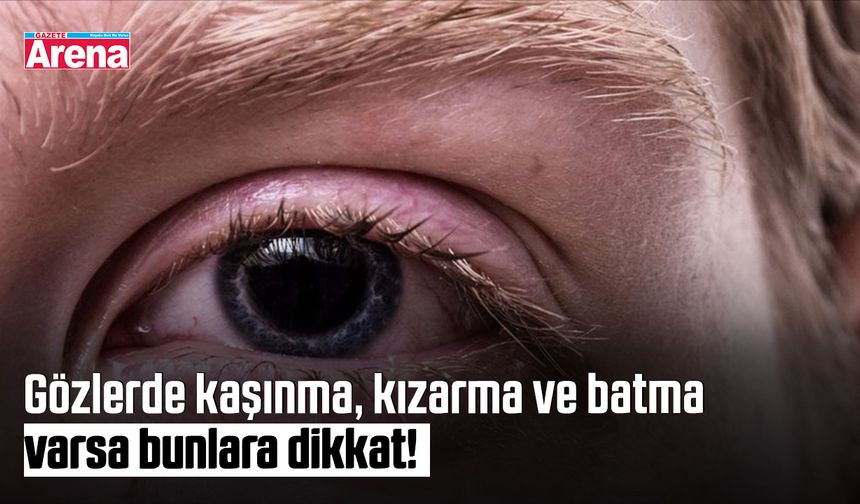 Gözlerde kaşınma, kızarma ve batma varsa bunlara dikkat!