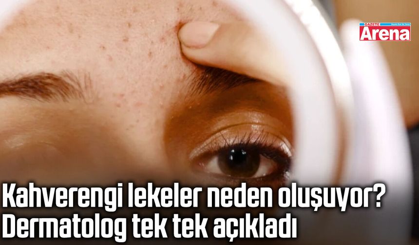 Kahverengi lekeler neden oluşuyor? Dermatolog tek tek açıkladı