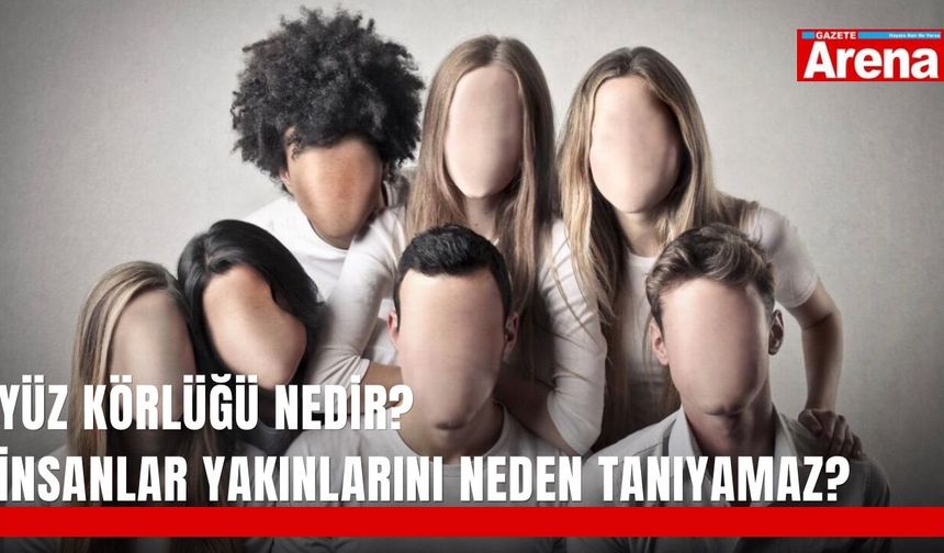 Yüz körlüğü nedir? İnsanlar yakınlarını neden tanıyamaz?