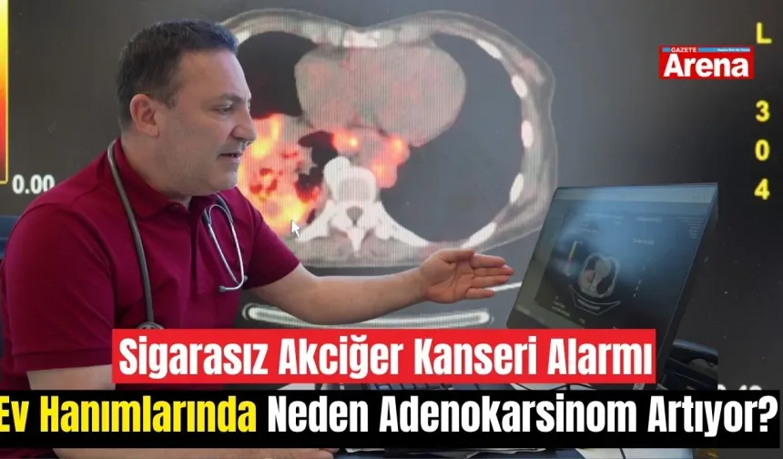 Sigarasız akciğer kanseri alarmı: Ev hanımlarında neden adenokarsinom artıyor?