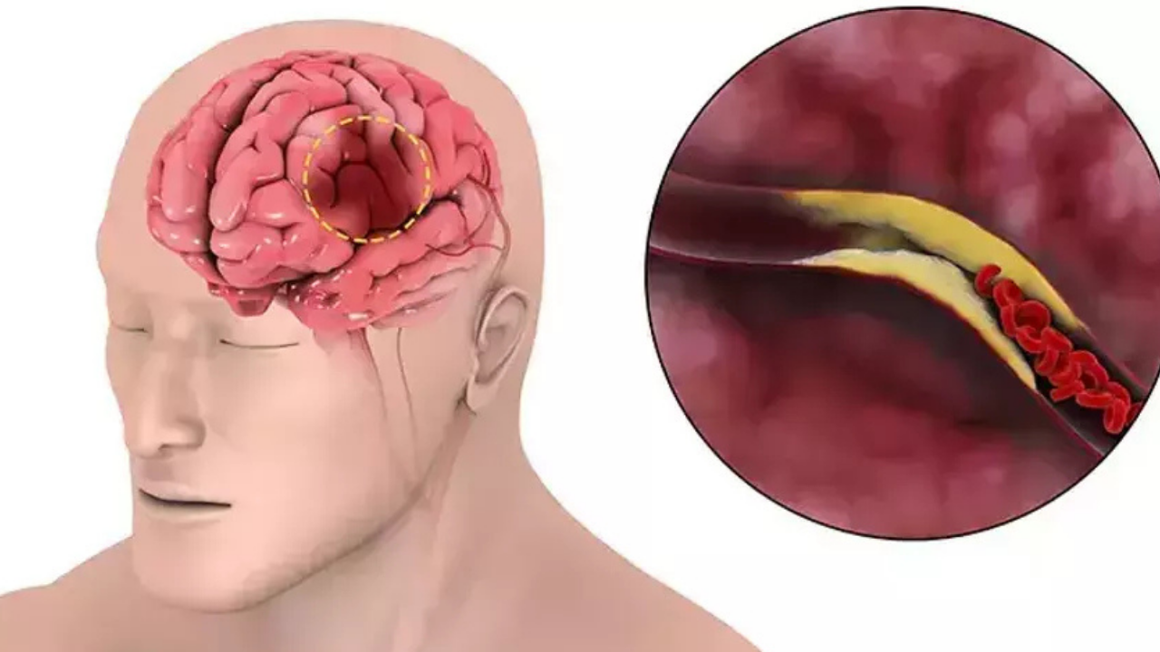 Adsız (1280 X 720 Piksel) 2025 10 29T192303.611