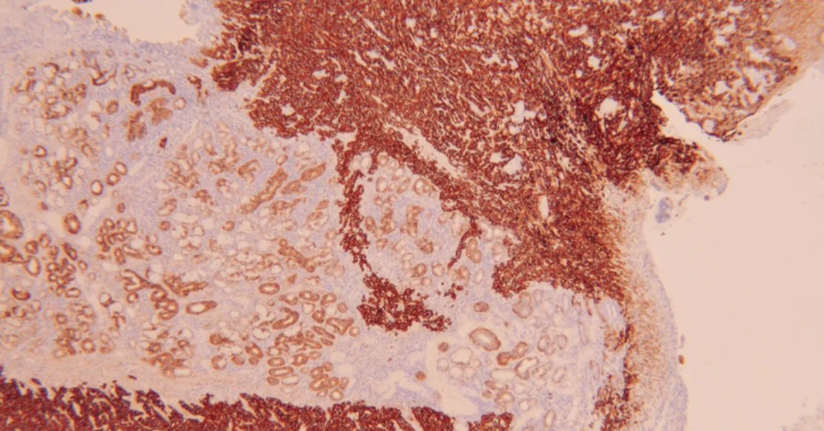 1200X627 Egfr Nedir Kanda Egfr Dusuklugu Ve Yuksekligi Ne Anlama Gelir S1 1603875416675