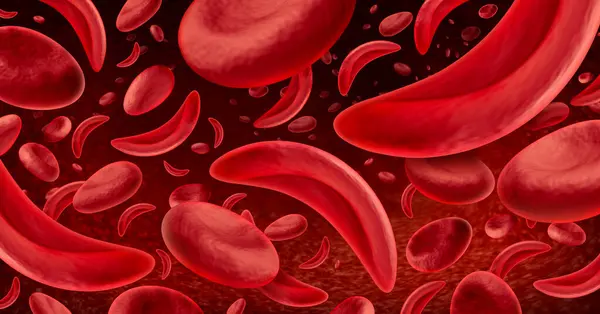 Depositphotos 745807818 Stock Photo Sickle Cell Anemia Red Blood